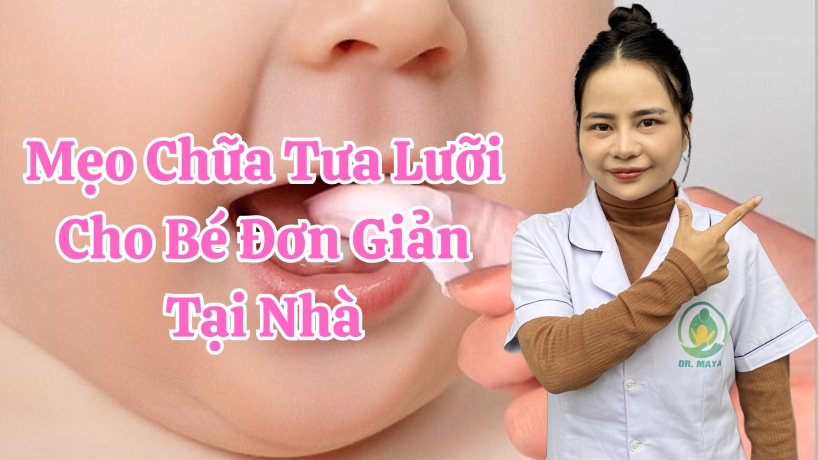 Mẹo Chữa Tưa Lưỡi Cho Bé Đơn Giản Tại Nhà